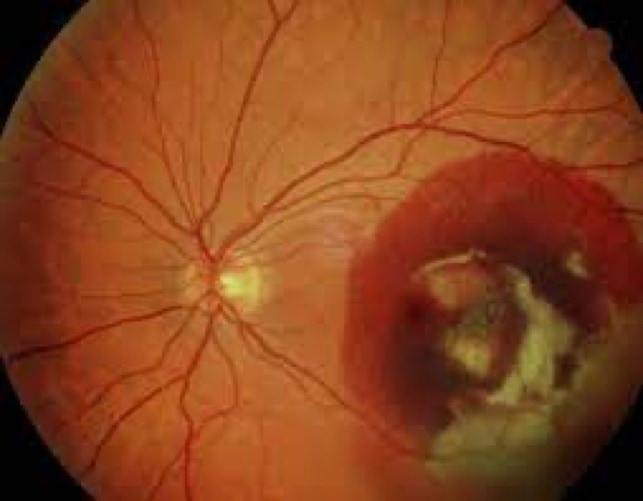 Schwarz Gerahmte Brille