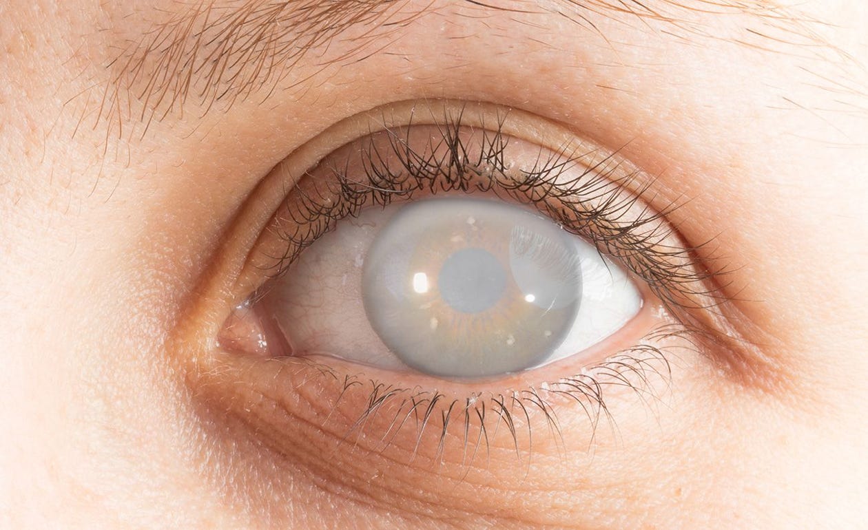 Schwarz Gerahmte Brille